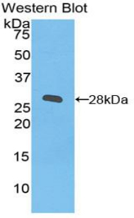 ITGB2 / CD18 Antibody - Western blot of recombinant ITGB2 / MAC-1 / CD18.  This image was taken for the unconjugated form of this product. Other forms have not been tested.