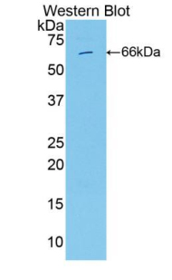 ITGB2 / CD18 Antibody - Western blot of ITGB2 / CD18 antibody.