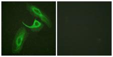 ITGB2 / CD18 Antibody - Immunofluorescence analysis of HeLa cells, using CD18/ITGB2 Antibody. The picture on the right is blocked with the synthesized peptide.