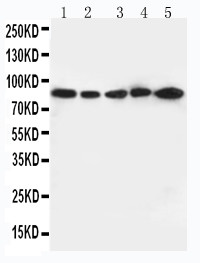 ITGB2 / CD18 Antibody - WB of ITGB2 / MAC-1 / CD18 antibody. All lanes: Anti-ITGB2 at 0.5ug/ml. Lane 1: JURKAT Whole Cell Lysate at 40ug. Lane 2: CEM Whole Cell Lysate at 40ug. Lane 3: HT1080 Whole Cell Lysate at 40ug. Lane 4: SMMC Whole Cell Lysate at 40ug. Lane 5: HELA Whole Cell Lysate at 40ug. Predicted bind size: 85KD. Observed bind size: 85KD.