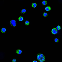 ITGB2 / CD18 Antibody - Confocal immunofluorescence of HL60 cells using CD18 mouse monoclonal antibody (green). Blue: DRAQ5 fluorescent DNA dye.