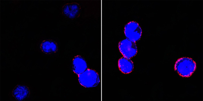 ITGB2 / CD18 Antibody - Confocal immunofluorescence of BCBL-1 cells (left) and L1210 cells (right) using CD18 mouse monoclonal antibody (red). Blue: DRAQ5 fluorescent DNA dye.