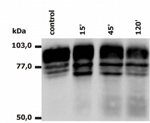 ITGB2 / CD18 Antibody - Western Blotting analysis of PMA-activated neutrophils (A) and monocytes (B), using anti-human CD18 (MEM-148).  The antibody MEM-148 recognizes the lower 65 to 70 kDa zone (activation marker) as well as the upper 78 to 96 kDa zone (CD18).