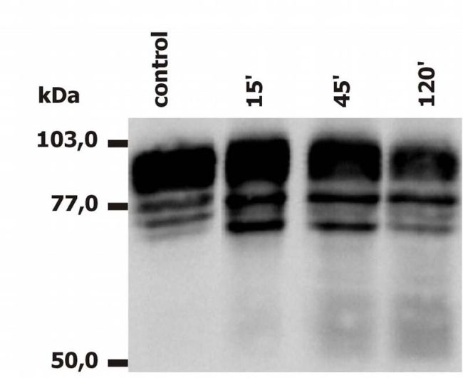 ITGB2 / CD18 Antibody - CD18 Antibody in Western Blot (WB)