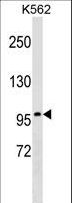 ITGB2 / CD18 Antibody - ITGB2 Antibody western blot of K562 cell line lysates (35 ug/lane). The ITGB2 antibody detected the ITGB2 protein (arrow).