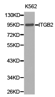 ITGB2 / CD18 Antibody - Western blot of extracts of K562 cell lines, using ITGB2 antibody.