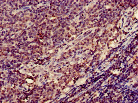 ITGB2 / CD18 Antibody - Immunohistochemistry of paraffin-embedded human lymph node tissue using ITGB2 Antibody at dilution of 1:100