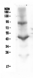 ITGB2 / CD18 Antibody - Western blot analysis of CD18 using anti-CD18 antibody. Electrophoresis was performed on a 5-20% SDS-PAGE gel at 70V (Stacking gel) / 90V (Resolving gel) for 2-3 hours. The sample well of each lane was loaded with 50ug of sample under reducing conditions. Lane 1: human placenta tissue lysate. After Electrophoresis, proteins were transferred to a Nitrocellulose membrane at 150mA for 50-90 minutes. Blocked the membrane with 5% Non-fat Milk/ TBS for 1.5 hour at RT. The membrane was incubated with mouse anti-CD18 antigen affinity purified monoclonal antibody at 0.5 µg/mL overnight at 4°C, then washed with TBS-0.1% Tween 3 times with 5 minutes each and probed with a goat anti-mouse IgG-HRP secondary antibody at a dilution of 1:10000 for 1.5 hour at RT. The signal is developed using an Enhanced Chemiluminescent detection (ECL) kit with Tanon 5200 system.