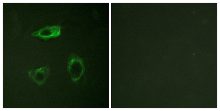 ITGB2 / CD18 Antibody - Immunofluorescence analysis of HepG2 cells, using CD18/ITGB2 (Phospho-Thr758) Antibody. The picture on the right is blocked with the phospho peptide.