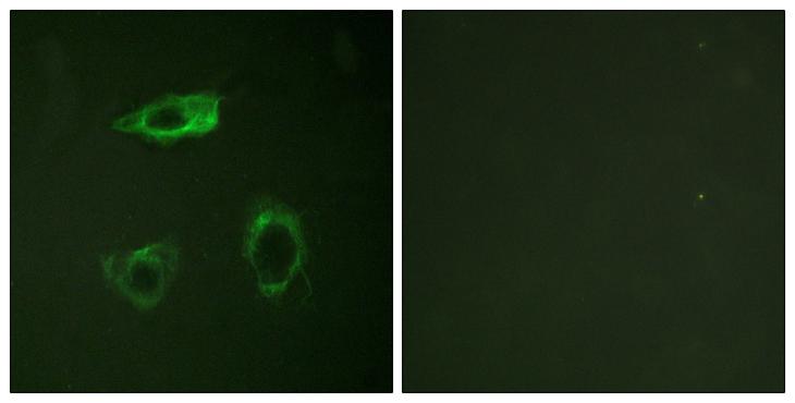 ITGB2 / CD18 Antibody - P-peptide - + Immunofluorescence analysis of HepG2 cells, using CD18/ITGB2 (Phospho-Thr758) antibody.