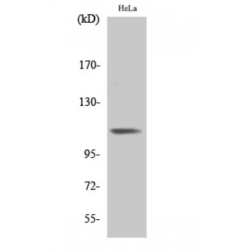 ITGB3 / Integrin Beta 3 / CD61 Antibody - Western blot of Phospho-Integrin beta3 (Y785) antibody
