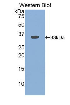 ITGB3 / Integrin Beta 3 / CD61 Antibody - Western blot of ITGB3 / Integrin Beta 3 / CD61 antibody.