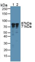 ITGB3 / Integrin Beta 3 / CD61 Antibody - Western Blot; Sample: Lane1: Human A549 Cells; Lane2: Human Liver Tissue.