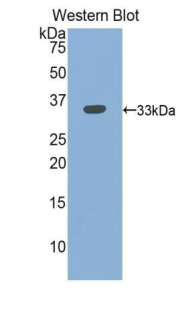ITGB3 / Integrin Beta 3 / CD61 Antibody - Western blot of recombinant ITGB3 / Integrin Beta 3 / CD61. This image was taken for the unconjugated form of this product. Other forms have not been tested.