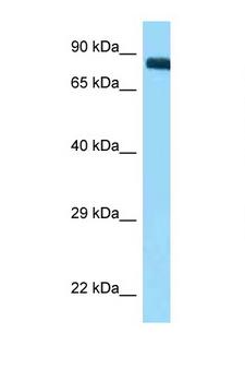 ITGB3 / Integrin Beta 3 / CD61 Antibody - ITGB3 / CD61 antibody Western blot of Placenta lysate. Antibody concentration 1 ug/ml.  This image was taken for the unconjugated form of this product. Other forms have not been tested.