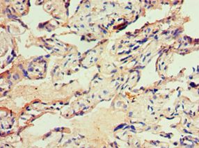 ITGB3 / Integrin Beta 3 / CD61 Antibody - Immunohistochemistry of paraffin-embedded human placenta using antibody at 1:100 dilution.
