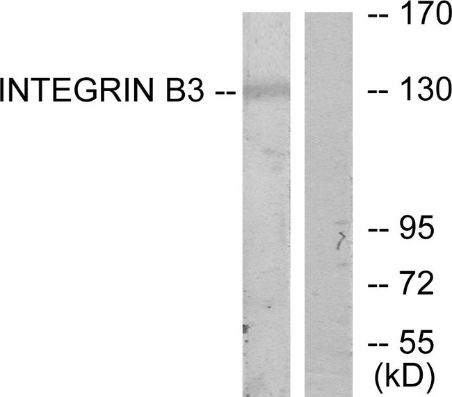 ITGB3 / Integrin Beta 3 / CD61 Antibody - Western blot analysis of lysates from HepG2 cells, using Integrin beta3 Antibody. The lane on the right is blocked with the synthesized peptide.