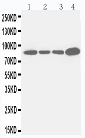 ITGB3 / Integrin Beta 3 / CD61 Antibody - WB of ITGB3 / Integrin Beta 3 / CD61 antibody. All lanes: Anti-ITGB3 at 0.5ug/ml. Lane 1: JURKAT Whole Cell Lysate at 40ug. Lane 2: RAJI Whole Cell Lysate at 40ug. Lane 3: CEM Whole Cell Lysate at 40ug. Lane 4: COLO320 Whole Cell Lysate at 40ug. Predicted bind size: 87KD. Observed bind size: 87KD.
