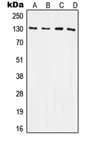 ITGB3 / Integrin Beta 3 / CD61 Antibody - Western blot analysis of CD61 expression in HeLa (A); Raw264.7 (B); NIH3T3 (C); H9C2 (D) whole cell lysates.