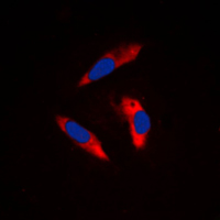ITGB3 / Integrin Beta 3 / CD61 Antibody - Immunofluorescent analysis of CD61 staining in Raw264.7 cells. Formalin-fixed cells were permeabilized with 0.1% Triton X-100 in TBS for 5-10 minutes and blocked with 3% BSA-PBS for 30 minutes at room temperature. Cells were probed with the primary antibody in 3% BSA-PBS and incubated overnight at 4 C in a humidified chamber. Cells were washed with PBST and incubated with a DyLight 594-conjugated secondary antibody (red) in PBS at room temperature in the dark. DAPI was used to stain the cell nuclei (blue).