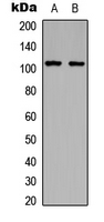 ITGB3 / Integrin Beta 3 / CD61 Antibody - Western blot analysis of CD61 (pY785) expression in HeLa (A); HepG2 (B) whole cell lysates.
