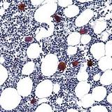 ITGB3 / Integrin Beta 3 / CD61 Antibody - Formalin-fixed, paraffin-embedded human bone marrow stained with CD61 antibody.