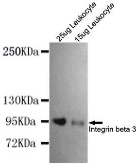 ITGB3 / Integrin Beta 3 / CD61 Antibody - Western blot detection of Integrin beta 3(N-terminus) in 15ug and 25ug Leukocyte whole cell lysate using Integrin beta 3(N-terminus) mouse monoclonal antibody (1:1000 dilution). Predicted band size: 110KDa. Observed band size:110KDa.