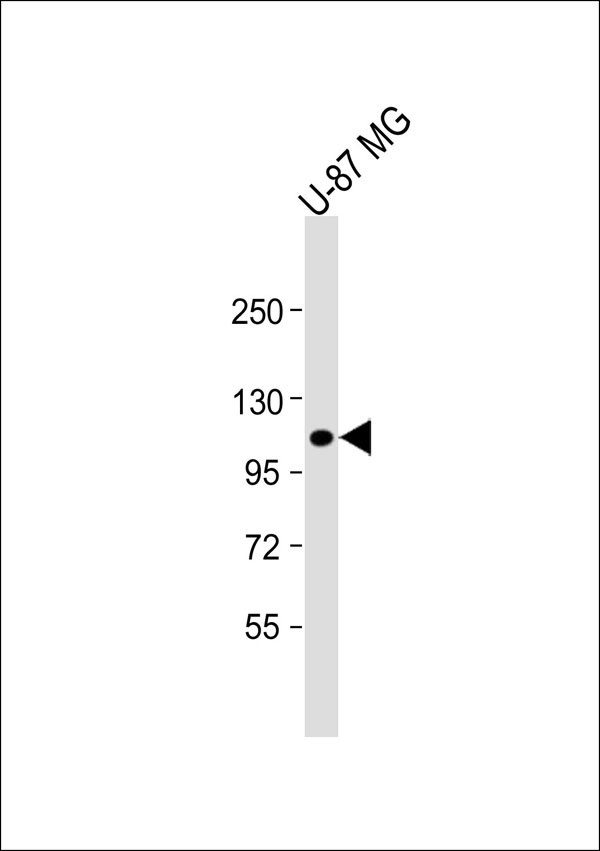 ITGB3 / Integrin Beta 3 / CD61 Antibody - Anti-CD61 Antibody at 1:1000 dilution + U-87 MG whole cell lysate Lysates/proteins at 20 ug per lane. Secondary Goat Anti-Rabbit IgG, (H+L), Peroxidase conjugated at 1:10000 dilution. Predicted band size: 87 kDa. Blocking/Dilution buffer: 5% NFDM/TBST.