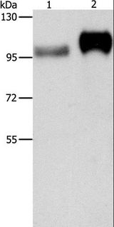 ITGB3 / Integrin Beta 3 / CD61 Antibody - Western blot analysis of Huvec cell and human placenta tissue, using ITGB3 Polyclonal Antibody at dilution of 1:500.