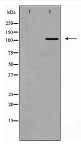 ITGB3 / Integrin Beta 3 / CD61 Antibody - Western blot of Integrin? alpha 3?(CD49c) expression in HepG2 cell