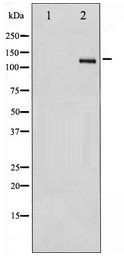 ITGB3 / Integrin Beta 3 / CD61 Antibody - Western blot of Integrin beta3 expression in HepG2 whole cell lysates,The lane on the left is treated with the antigen-specific peptide.