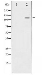 ITGB3 / Integrin Beta 3 / CD61 Antibody - Western blot of Integrin beta3 expression in NIH-3T3 whole cell lysates,The lane on the left is treated with the antigen-specific peptide.