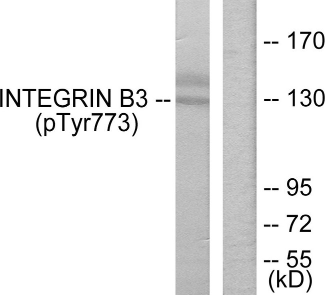 ITGB3 / Integrin Beta 3 / CD61 Antibody - Western blot analysis of lysates from HL-60 cells treated with H2O2, using Integrin beta3 (Phospho-Tyr773) Antibody. The lane on the right is blocked with the phospho peptide.
