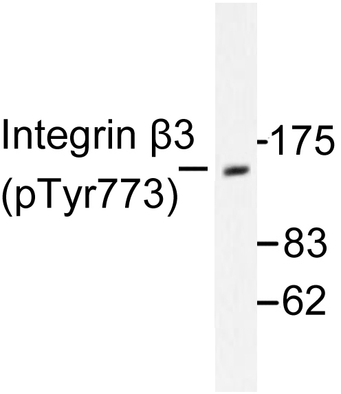 ITGB3 / Integrin Beta 3 / CD61 Antibody - Western blot of p-Integrin 3 (Y773) pAb in extracts from COS7 cells treated with Insulin 0.01U/ml 15'.