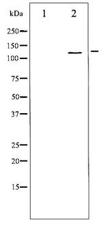 ITGB3 / Integrin Beta 3 / CD61 Antibody - Western blot of Integrin beta3 phosphorylation expression in H2O2 treated 293 whole cell lysates,The lane on the left is treated with the antigen-specific peptide.