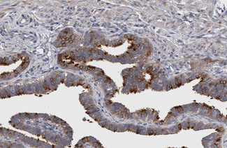 ITGB3 / Integrin Beta 3 / CD61 Antibody - 1:200 staining human Fallopian tube sections by IHC-P. The tissue was formaldehyde fixed and a heat mediated antigen retrieval step in citrate buffer was performed. The tissue was then blocked and incubated with the antibody for 1.5 hours at 22° C. An HRP conjugated goat anti-rabbit antibody was used as the secondary.