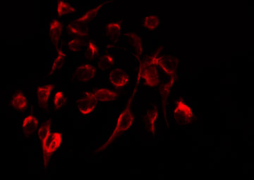 ITGB3 / Integrin Beta 3 / CD61 Antibody - Staining HepG2 cells by IF/ICC. The samples were fixed with PFA and permeabilized in 0.1% Triton X-100, then blocked in 10% serum for 45 min at 25°C. The primary antibody was diluted at 1:200 and incubated with the sample for 1 hour at 37°C. An Alexa Fluor 594 conjugated goat anti-rabbit IgG (H+L) Ab, diluted at 1/600, was used as the secondary antibody.