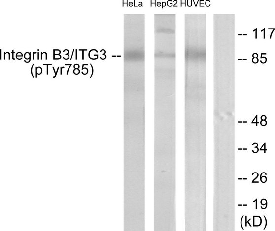 ITGB3 / Integrin Beta 3 / CD61 Antibody - Western blot analysis of lysates from HeLa cells, HepG2 cells and HUVEC cells, using Integrin beta3 (Phospho-Tyr785) Antibody. The lane on the right is blocked with the phospho peptide.