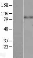 ITGB3 / Integrin Beta 3 / CD61 Protein - Western validation with an anti-DDK antibody * L: Control HEK293 lysate R: Over-expression lysate