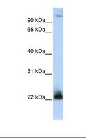 ITGB3BP Antibody - MCF7 cell lysate. Antibody concentration: 1.0 ug/ml. Gel concentration: 12%.  This image was taken for the unconjugated form of this product. Other forms have not been tested.