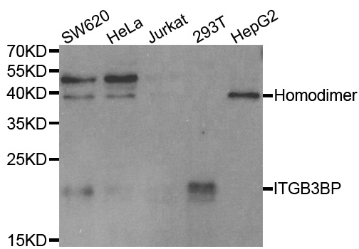 ITGB3BP Antibody - Western blot analysis of extracts of various cell lines.