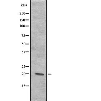 ITGB3BP Antibody - Western blot analysis of CENPR expression in A431 cell lysates at 25ug/lane. The lane on the left is treated with the antigen-specific peptide.