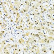ITGB3BP Antibody - Immunohistochemistry of paraffin-embedded Human liver using ITGB3BP Polyclonal Antibody at dilution of 1:100 (40x lens).