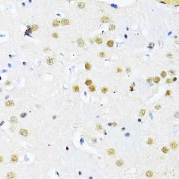 ITGB3BP Antibody - Immunohistochemistry of paraffin-embedded Mouse brain using ITGB3BP Polyclonal Antibody at dilution of 1:100 (40x lens).
