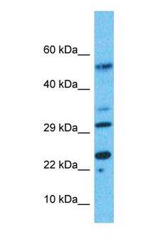 ITGB3BP Antibody - Western blot of ITGB3BP Antibody with human Gallbladder Tumor lysate.  This image was taken for the unconjugated form of this product. Other forms have not been tested.