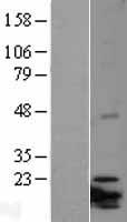 ITGB3BP Protein - Western validation with an anti-DDK antibody * L: Control HEK293 lysate R: Over-expression lysate