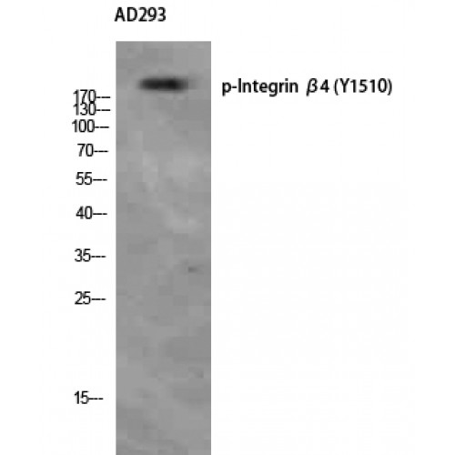 ITGB4 / Integrin Beta 4 Antibody - Western blot of Phospho-Integrin beta4 (Y1510) antibody