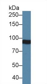 ITGB4 / Integrin Beta 4 Antibody - Western Blot; Sample: Mouse Serum; Primary Ab: 2µg/ml Rabbit Anti-Mouse ITGb4 Antibody Second Ab: 0.2µg/mL HRP-Linked Caprine Anti-Rabbit IgG Polyclonal Antibody