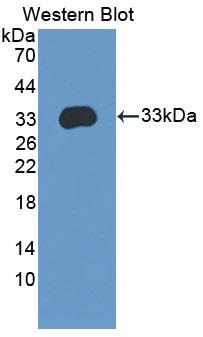 ITGB4 / Integrin Beta 4 Antibody - Western blot of ITGB4 / Integrin Beta 4 antibody.