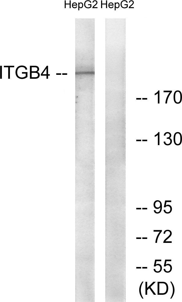 ITGB4 / Integrin Beta 4 Antibody - Western blot analysis of lysates from HepG2 cells, treated with PMA 125ng/ml 30', using Integrin beta4 Antibody. The lane on the right is blocked with the synthesized peptide.